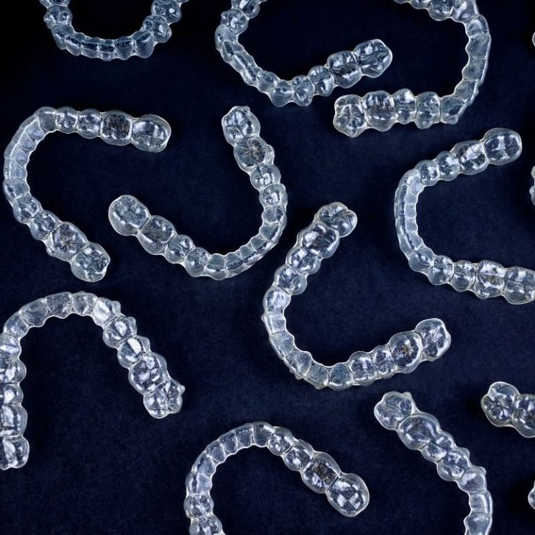 Am I a Candidate for Clear Aligners