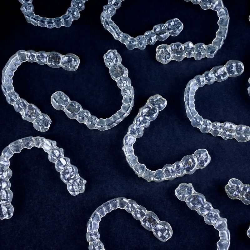 Am I a Candidate for Clear Aligners