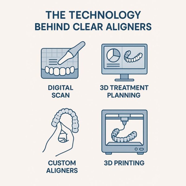 The Technology Behind Clear Aligners