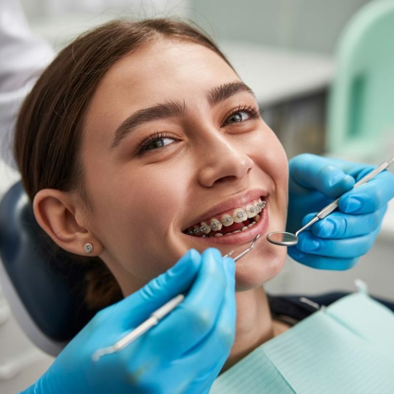 affordable braces